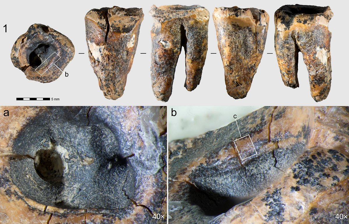 Болели ли неандертальцы кариесом и как они лечили зубы? Фото © journals.plos.org
