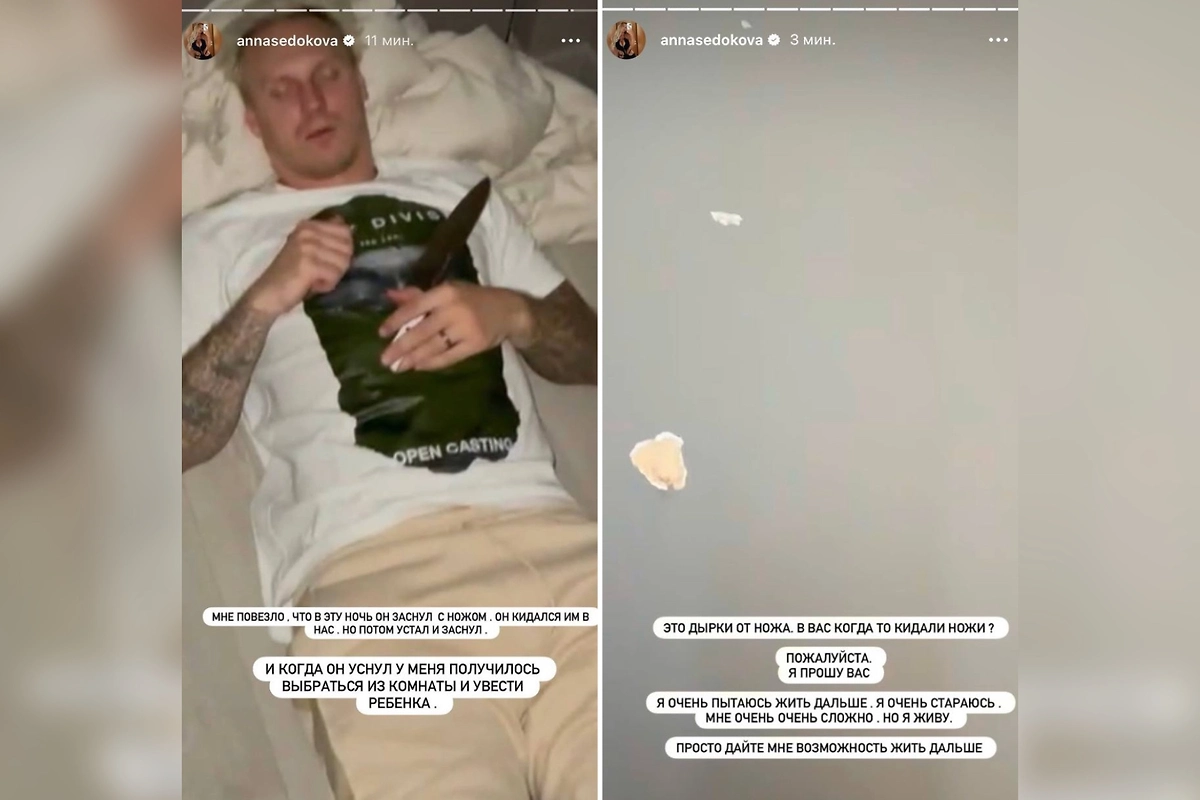 Анна Седокова впервые рассказала об избиениях со стороны Яниса Тиммы. Фото © Instagram (признан экстремистской организацией и запрещён на территории Российской Федерации) / annasedokova