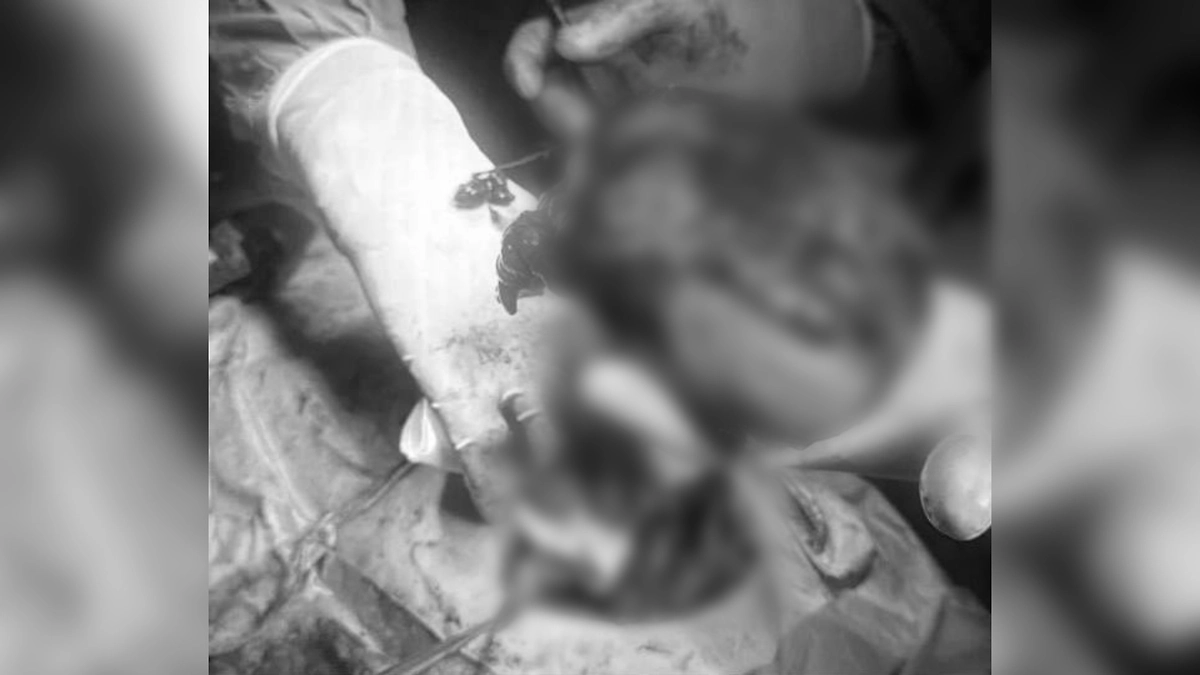 Подмосковные хирурги удалили девочке опухоль, занимавшую половину грудной клетки. Фото © НИИ неотложной детской хирургии и травматологии. Клиника доктора Рошаля