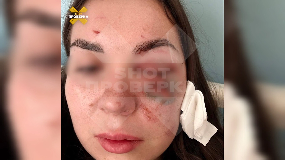 В Балашихе водонагреватель взорвался перед лицом девушки. Фото © Telegram / SHOT ПРОВЕРКА
