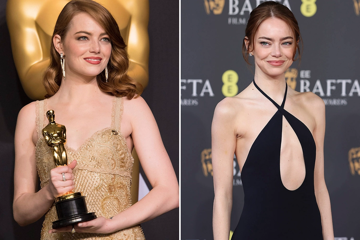 Эмма Стоун на BAFTA 2026: почему её внешний вид напугал поклонников? Фото © ТАСС / Ampas, Stephen Lock / i-Images
