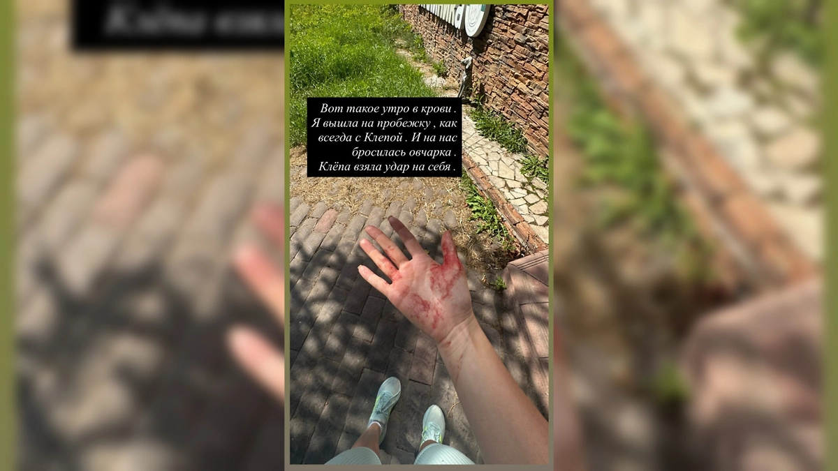 Илана Дылдина едва не пострадала от нападения агрессивной овчарки на Рублёвке. Фото © Instagram (признан экстремистской организацией и запрещён на территории Российской Федерации)/ilana7788