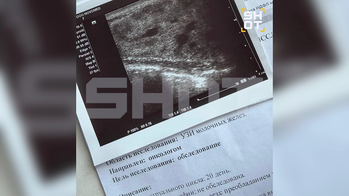 Жительница Подмосковья попала в больницу с воспалением груди после бани. Фото © Telegram / SHOT