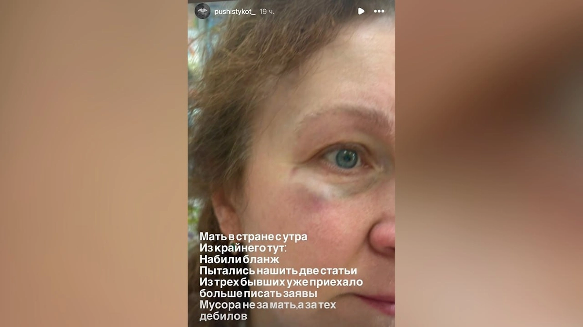 Последствия избиения. Фото © Instagram (признан экстремистской организацией и запрещён на территории Российской Федерации)/ pushistykot_