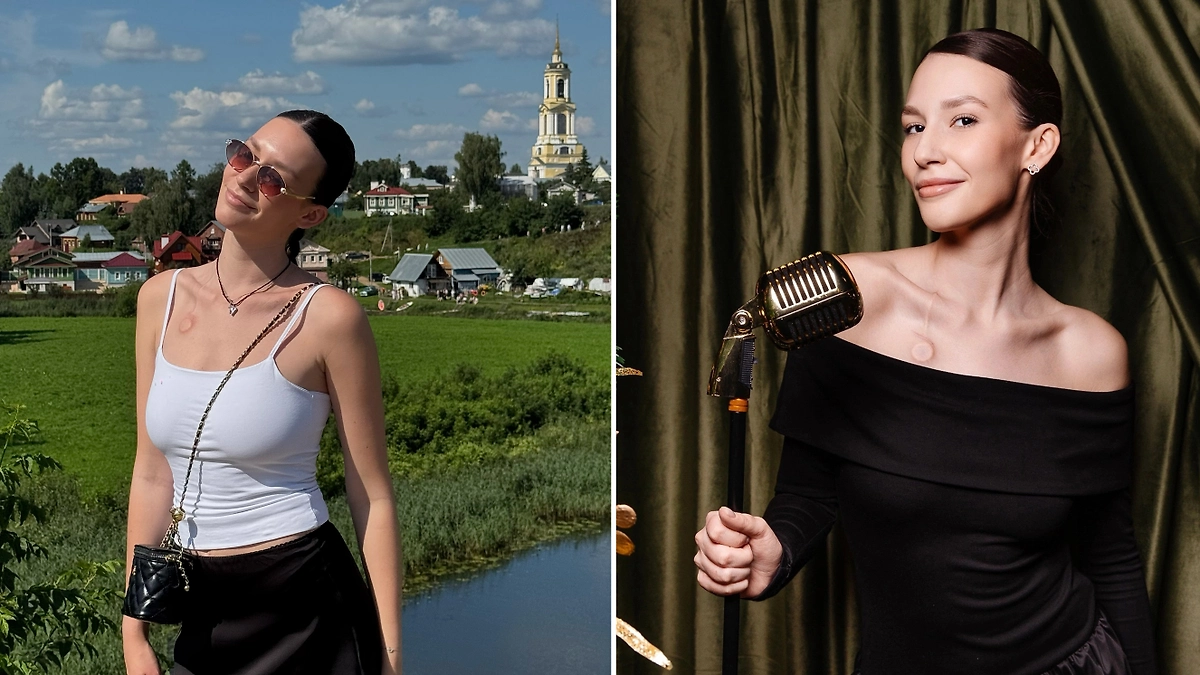 Платье с открытыми плечами: как Полина решила не прятать порт-систему? Фото предоставлено Полиной