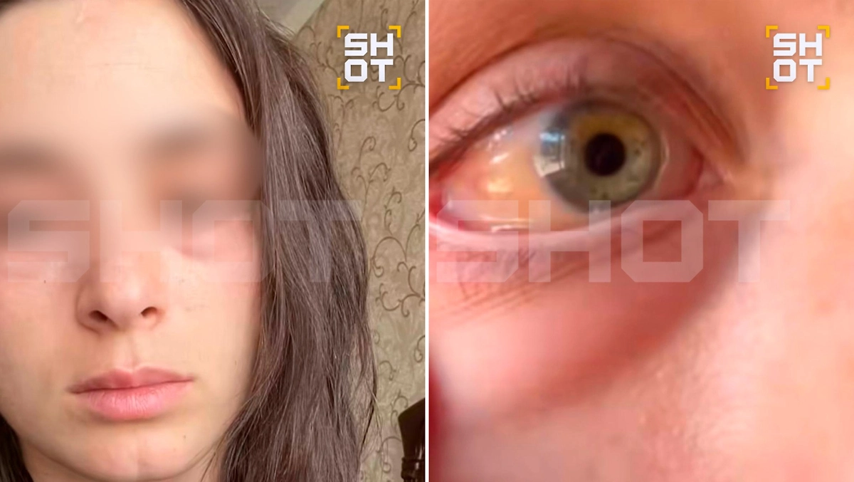 Жители Кубани жалуются на удушье и отёки из-за цветения амброзии. Фото © SHOT
