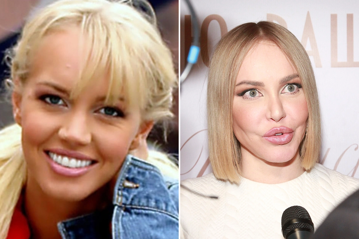 Пластика кардинально изменила Машу Малиновскую. Фото © biographe, © ТАСС / Сергей Виноградов