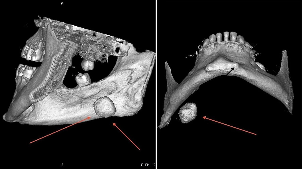 Фото © Telegram / Краевая клиническая больница №2