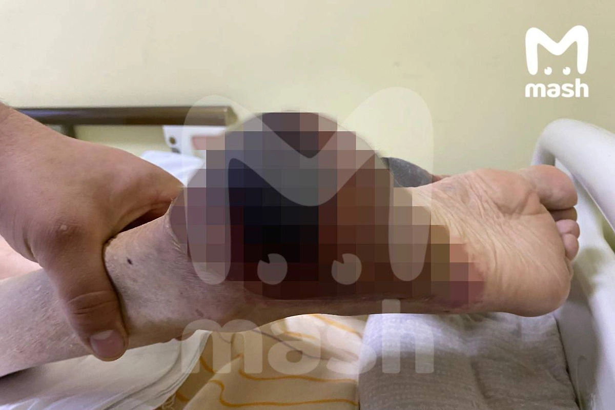 В Обнинске минимум 20 человек обварились кипятком из-за бездействия УК. Фото © Telegram / Mash