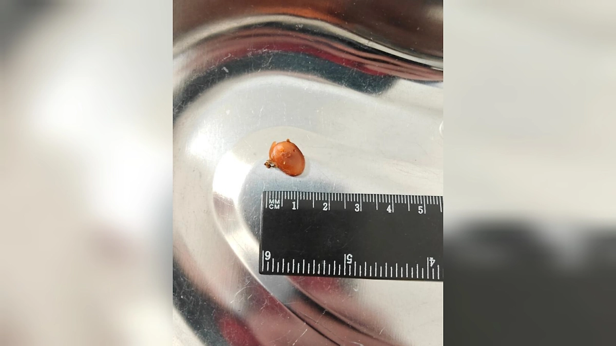 Тот самый кусочек беруши. Фото © Минздрав Подмосковья