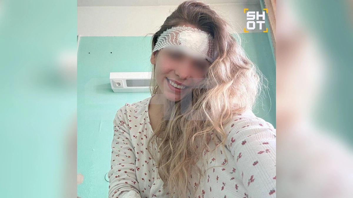 Россиянке потребовалось операция после того, как она выдавила прыщ на лбу. Фото © SHOT