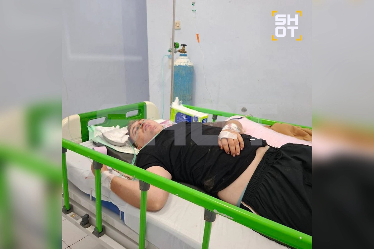 Россиянин попал в страшное ДТП на Бали, у него паралич позвоночника и жуткие переломы. Фото © SHOT