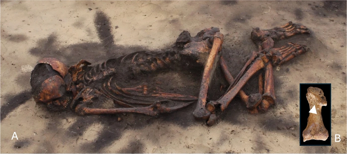 Изучавшиеся останки. Фото © Journal of Archaeological Method and Theory / A — Museum of Northern Jutland; B — The BODY-POLITICS project