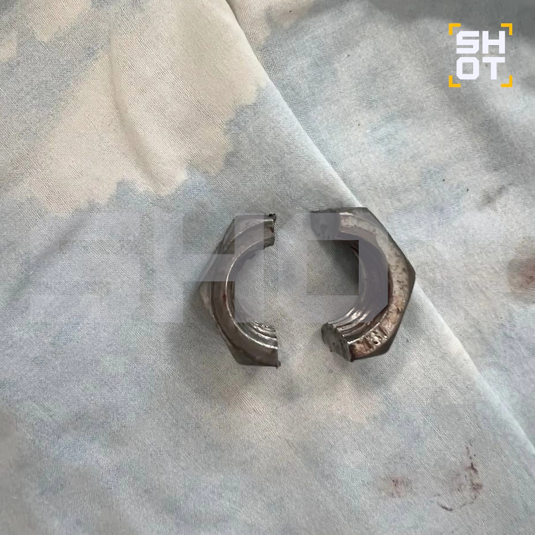 Подмосковные хирурги спасли мужчину с накрученной на половой орган гайкой. Фото © Telegram / SHOT