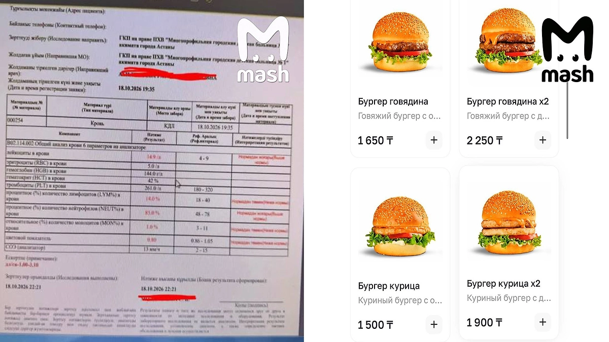 Подросток из РФ попал в больницу с отёком Квинке после бургера в Казахстане. Фото © Telegram / Mash 