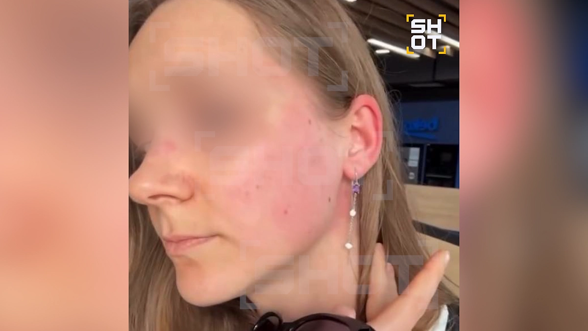 На вокзале Тбилиси избили туристку из Минска из-за русской речи. Фото © Telegram / SHOT