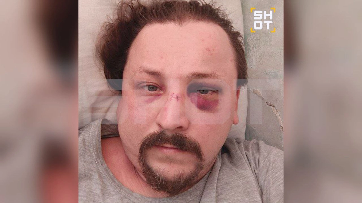 Травмы пострадавшего. Фото © SHOT