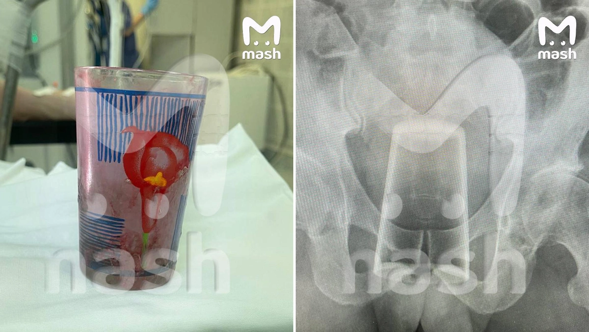 Фото © Telegram/Mash