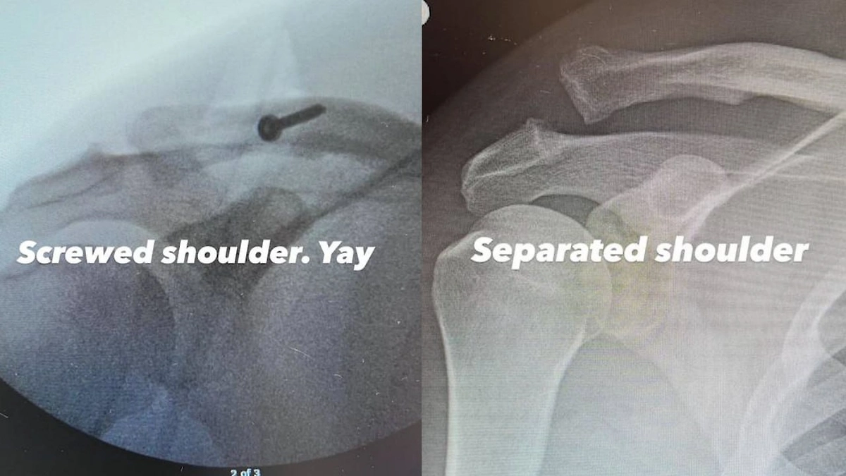 Травмы Ченнинга Татума. Коллаж © Instagram (признан экстремистской организацией и запрещён на территории Российской Федерации) / channingtatum