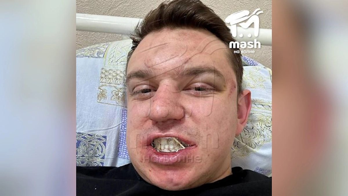 Официант после избиения длиною в час. Фото © Telegram / Mash на волне