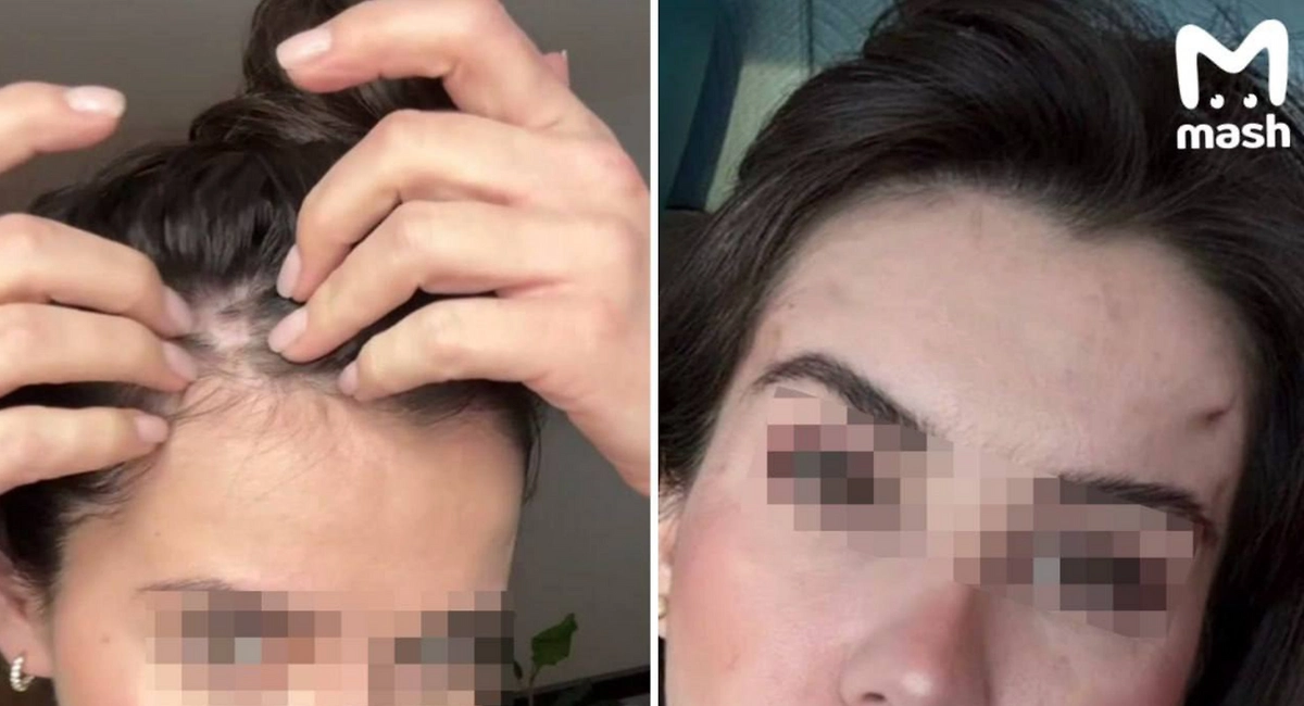 Пациентка обвинила московского хирурга в неудачной пластике и домогательствах.  Фото © Mash