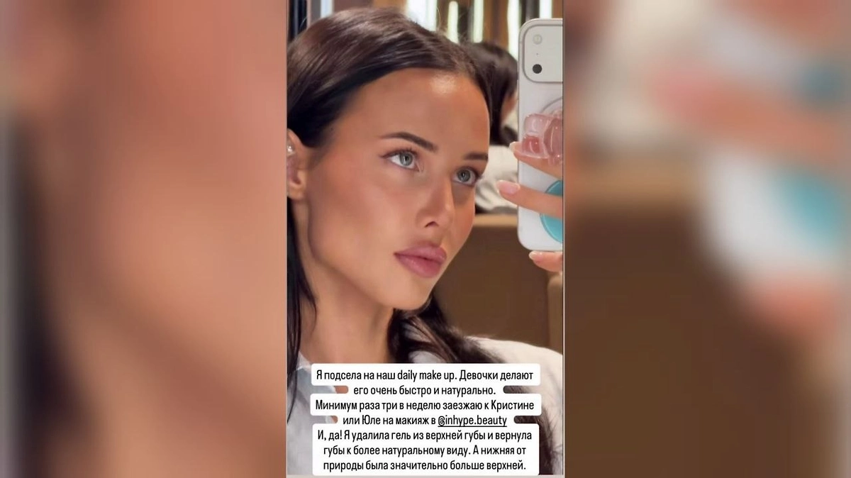 Решетова сдула верхнюю губу. Фото © Instagram (признан экстремистской организацией и запрещён на территории Российской Федерации) / a.reshotova