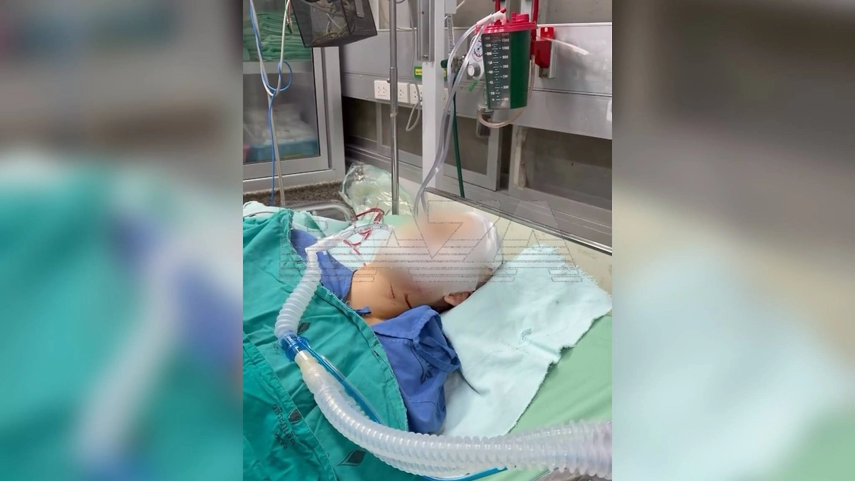 Россиянка впала в кому после аварии на Пхукете/ Фото © Telegram / BAZA