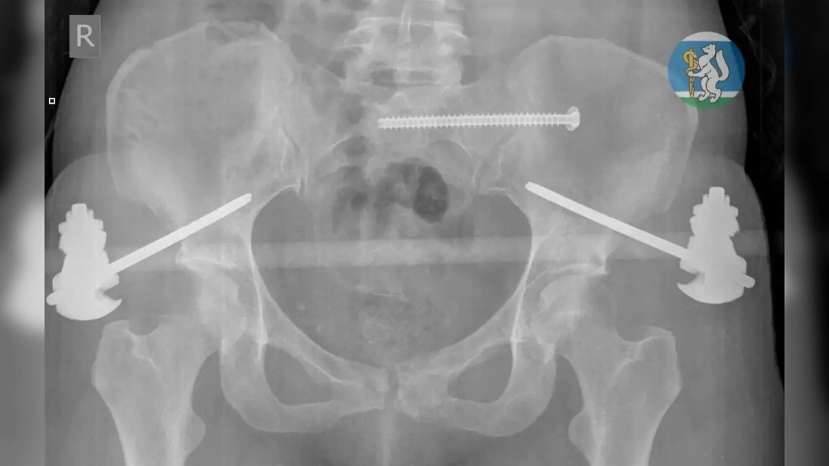 В Екатеринбурге врачи спасли женщину после падения с седьмого этажа. Фото © Telegram / Здоровье уральцев