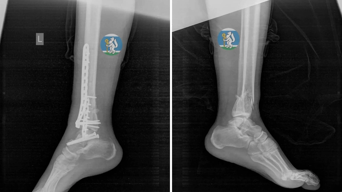 В Екатеринбурге врачи спасли женщину после падения с седьмого этажа. Фото © Telegram / Здоровье уральцев