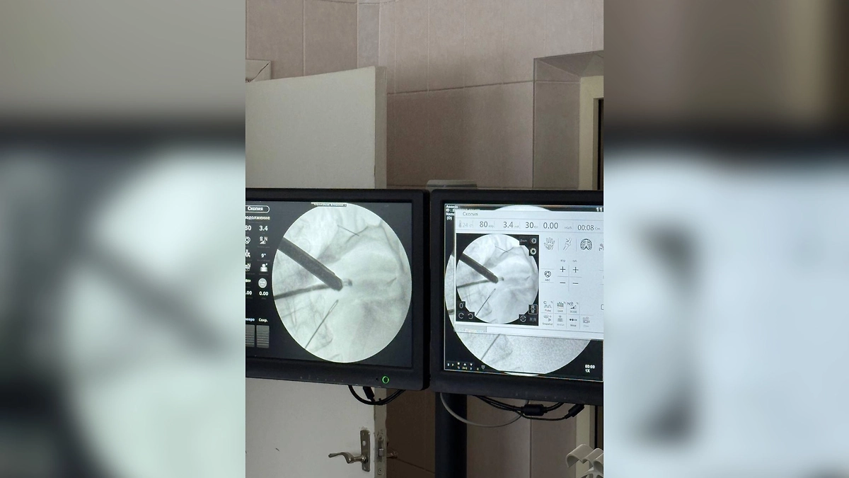 Женщину, проглотившую четыре швейные иглы спасли в Красногорске. Фото © пресс-служба Минздрава Московской области