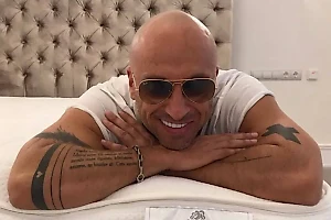 Стоматолог оценила протезирование у Нагиева и посоветовала не брать с него пример