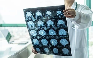 Врачи Ступинской больницы в Подмосковье спасли 31-летнюю курильщицу с инсультом