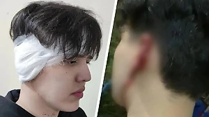 Челябинский «Тайсон» посреди ночи напал на студентов из-за тату и отгрыз одному ухо