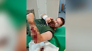 "Боевая рана" Дацика на СВО оказалась следствием нападения собак