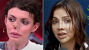 Алиса Аршавина назвала истинную причину, почему решилась на пластику гниющего носа