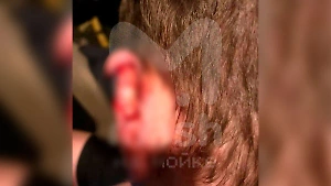 В Ленинградской области пьяная девушка отгрызла ухо соседу сверху из-за шума