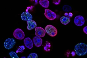 CoViD-19 отдыхает: Учёные всего мира соберутся, чтобы обсудить смертоносную "болезнь X"