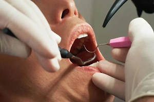 Россиянам рассказали, как одним вопросом выявить стоматолога-дилетанта