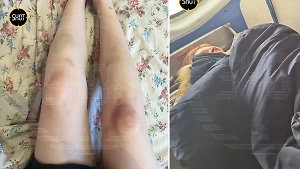 "Прыгали на мне": Отправившийся с квеста в Москве в больницу подросток рассказал, что испытал