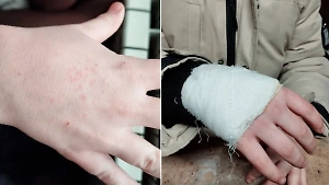 "Тебе нравится?": Уральская учительница 27 раз уколола второклассника циркулем
