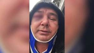 Под Киевом военкомы до полусмерти избили дальнобойщика с повесткой на глазах у полиции