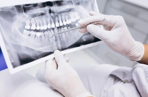 Стоматолог объяснила, от недостатка каких витаминов крошатся зубы и пахнет изо рта