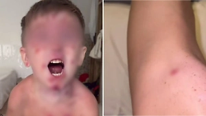 Семья россиян с ребёнком подхватила загадочный недуг на Бали