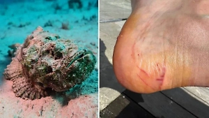 Россиянина покусала неизвестная рыба на Маврикии, это может быть ядовитейшая бородавчатка