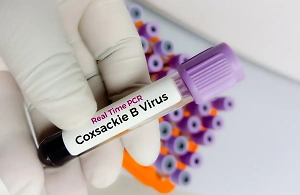 Роспотребнадзор оценил риски распространения вируса Коксаки в России