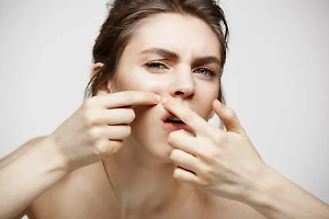 Дерматолог объяснила, как правильно давить прыщи дома