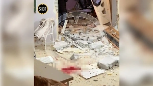 Пострадавший из-за взрыва в Элисте росгвардеец находится в тяжёлом состоянии