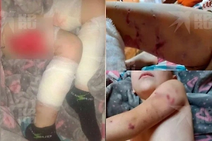 Стая бродячих псов едва не загрызла до смерти мальчика под Иркутском