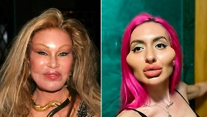 6 девушек-фриков заигрались в пластику и стали посмешищем