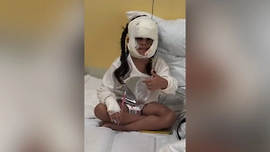 Волновалась только мама: Девочка с «маской Бэтмена» успешно перенесла очередную операцию